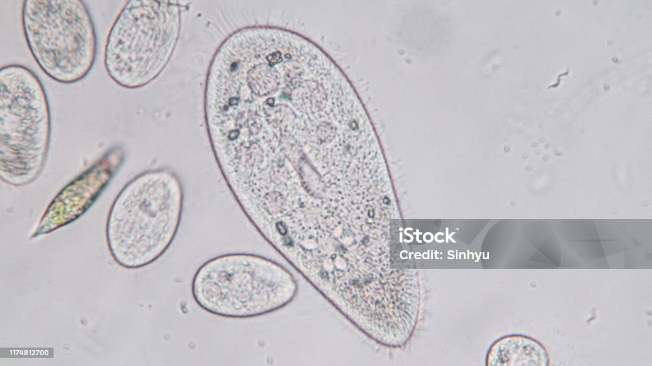 No momento, você está visualizando Protozoários: Diversidade, Estrutura e Funções no Reino Protista