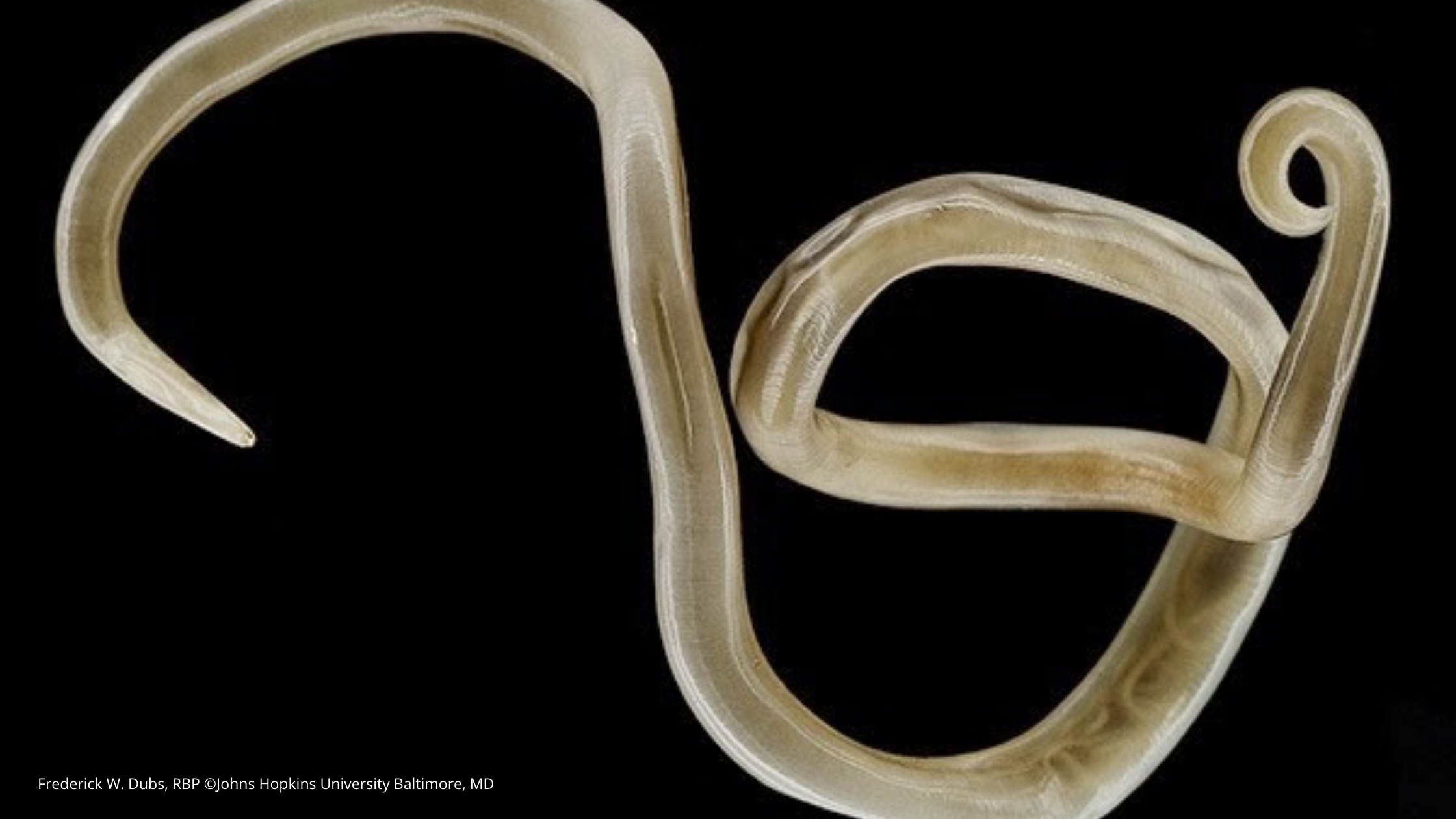 No momento, você está visualizando Filo Nematoda – Nematelmintos